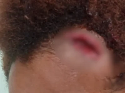 Brazil Man Attacks Ex-Girlfriend and Friends With Motorcycle Cane, Flees